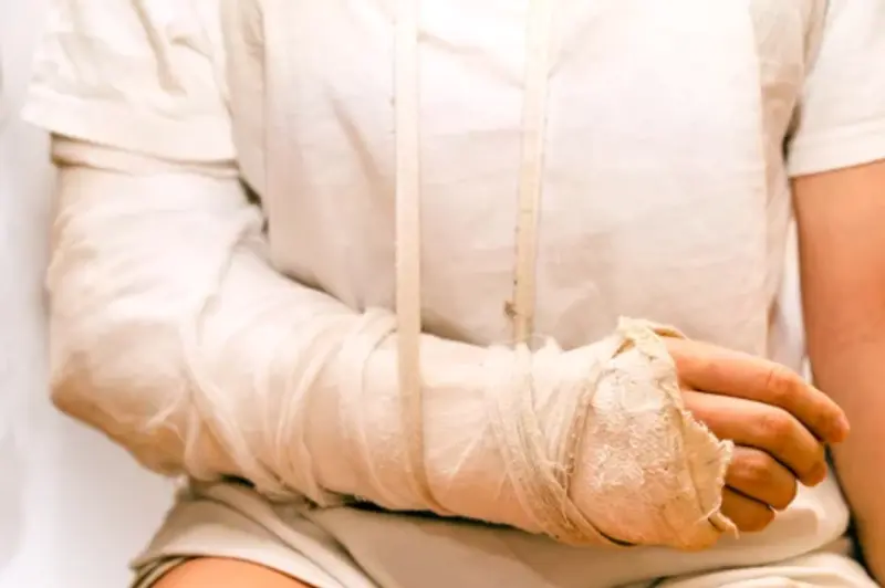 Catastrophic Injury — personal injury lawyer in Glendale, CA